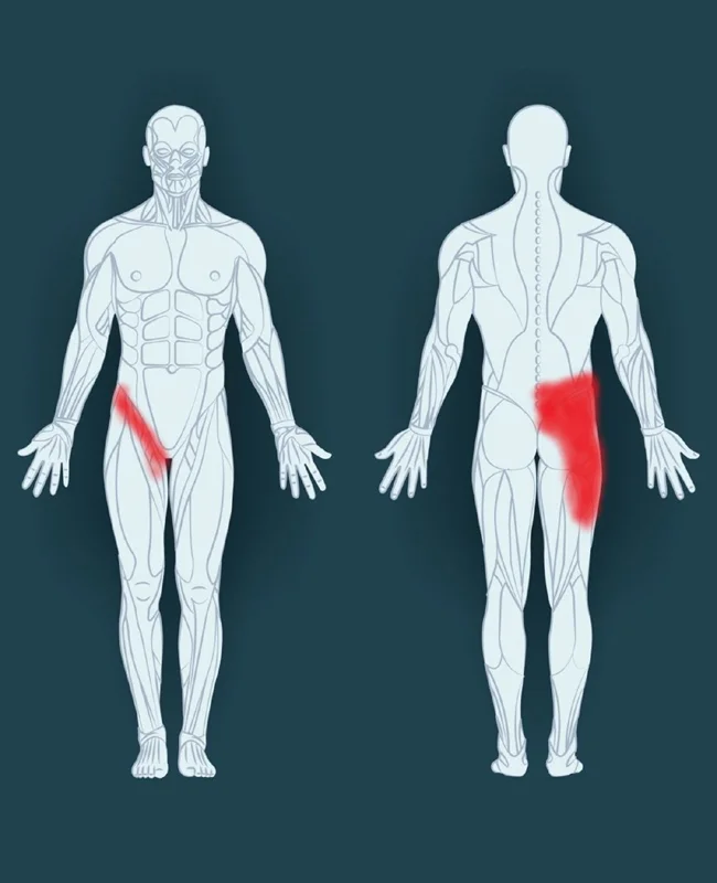 Groin Injuries